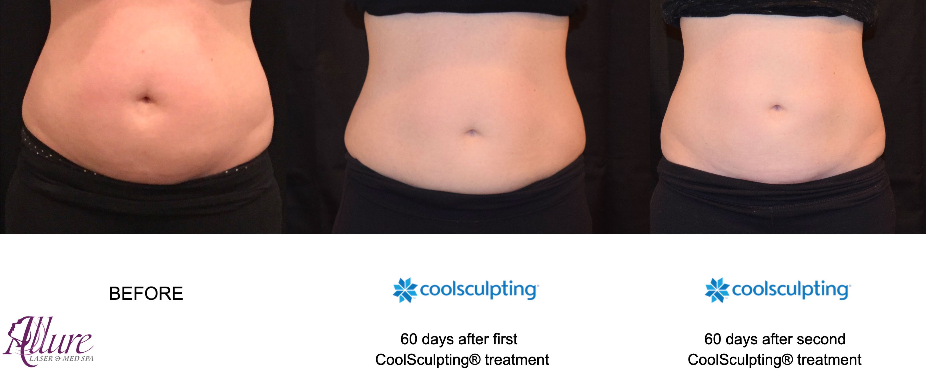 Allure Laser and Med Spa